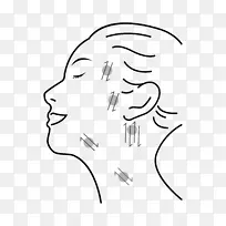 眼睛淋巴前额夹术.眼睛