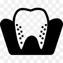 牙科医学牙齿美白