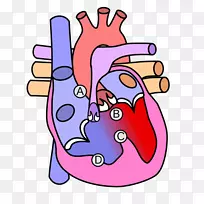先天性心脏缺损主动脉瓣图解剖-心脏
