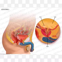 超声检查良性前列腺增生前列腺畸胎-番茄红素降低前列腺风险