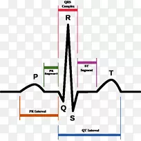 QT间期长Qt综合征Pr间期QRs复合心电图心率心电图