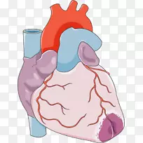 心脏急性心肌梗死冠状动脉旁路手术心血管疾病-心脏