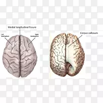 脑半球脑功能偏侧化