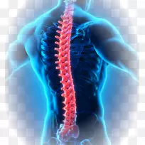 外科药物治疗强直性脊柱炎肩痛