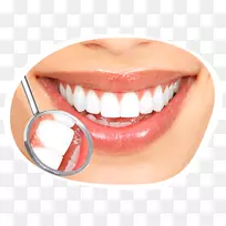 牙齿美白美容牙科人类牙齿微笑