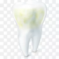 牙釉质牙齿磨损蛀牙酸黄牙