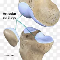 关节软骨损伤关节软骨修复Cartílago关节