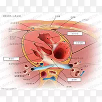 心脏瓣膜心房左室二尖瓣关闭不全-心脏