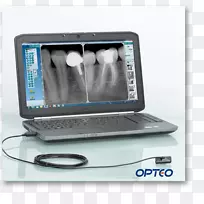 牙科放射学传感器数字射线照相牙科放射摄影.牙科医疗设备