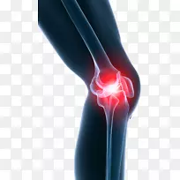 膝关节疼痛，肩痛，干细胞疗法，膝关节疼痛