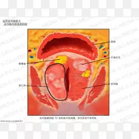 前列腺解剖膀胱磁共振成像肥大生殖系统