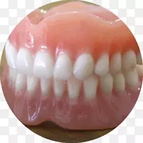 假牙、牙科种植体、牙冠