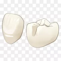 歯科-冠