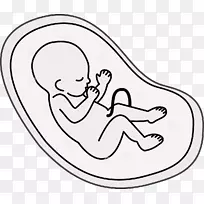 胎儿卡通妊娠-妊娠