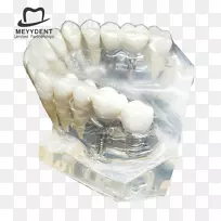 人类牙齿实验室หจก.เมย์เด้นท์颌骨-牙科模型