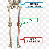 膝骨关节炎膝外翻膝関節骨-FTA