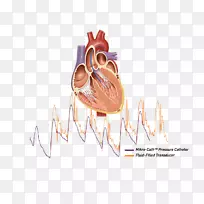 心导管心血管病实验室-心脏