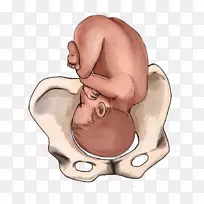 分娩，胎儿位置，婴儿臀位，出生-妊娠