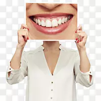 牙科美容贴面牙种植体-冠