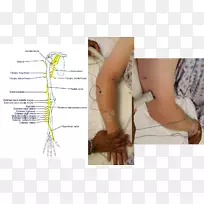 拇指桡神经腋神经肌肉