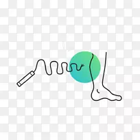 腓肠肌损伤