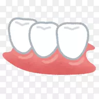 牙科义齿可摘局部义齿治疗义齿