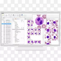 血液学全血计数白细胞显微镜
