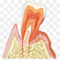 牙科牙周病歯科牙龈-牙龈疾病