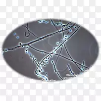真皮芽鞘菌母细胞病白色皮埃德拉显微镜