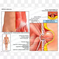 脐疝腹腔镜腹股沟疝修补术-肚脐解剖