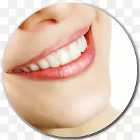 漂白牙齿美白牙科.漂白剂
