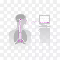 神经调节通气辅助机械通气导管医用呼吸机腹部移动