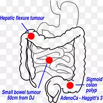 大肠、小肠、胃肠道、人类消化系统解剖-多重解剖