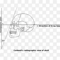 /m/02csf EAR文件绘图-肢端肥大