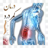 脊柱疼痛腰椎间盘突出症下腰痛脊柱背痛