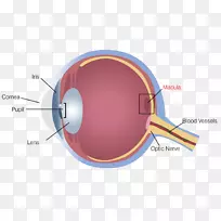 浮性视网膜脱离光敏性眼科学-眼