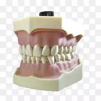 牙科排印-牙辅音-牙髓