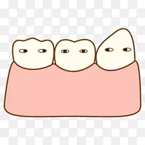 牙科歯科牙菌斑生活歯髄切断法-Teath