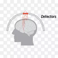 脑地形图脑磁图脑成像磁场脑冠状面