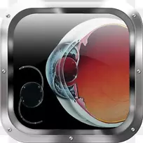 人工晶状体视网膜脱离白内障手术