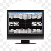 牙科数字X线摄影牙齿