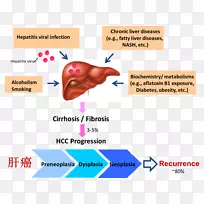 肝病、肝癌、肝细胞癌纤维化
