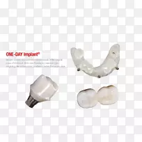 牙种植体基牙临时冠cad/cad牙科.牙科植入物