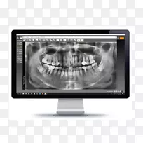 计算机监控医学影像多媒体产品设计-橙色牙医