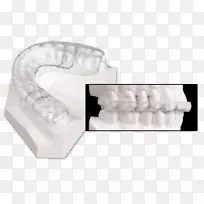 颌骨夹板、上颌牙科学、颞下颌关节功能障碍-下颌推进夹板