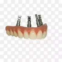 牙桥义齿修复牙科.牙科实验室