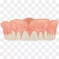 牙科可摘局部义齿.高等级遮阳