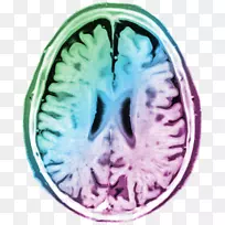 脑组织计算机断层扫描-心灵的平静