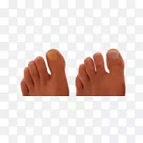 指甲手模型拇指-指甲脚