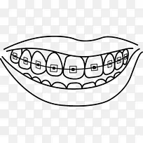牙科牙床-人牙列-牙洞